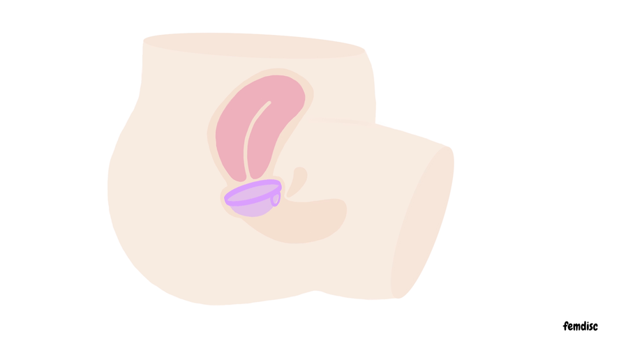 Rimozione pulita, senza stress